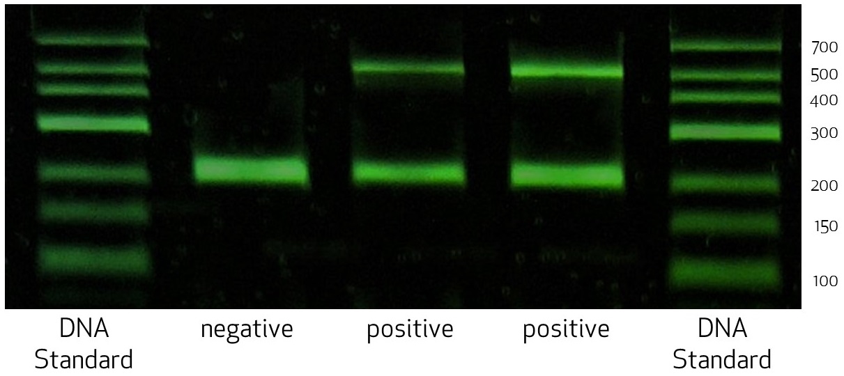 pcr experiment result